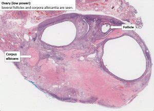 Ovary – Normal Histology – NUS Pathweb :: NUS Pathweb