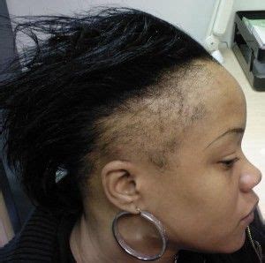 Black Hair Breakage Around Edges - Kitchen Rugs At Target