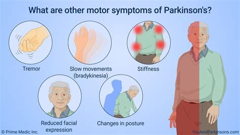 Pin on Animated Parkinson's Patient