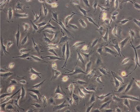 ESA - Endothelial cells