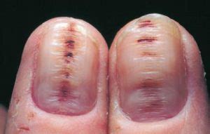 15 Health WARNINGS Your Fingernails Are Sending