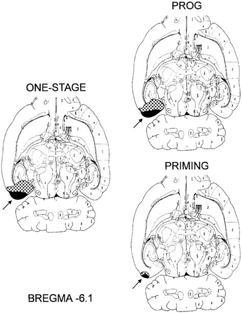 Minimum and maximum extent of entorhinal lesions. As the examples of... | Download Scientific ...