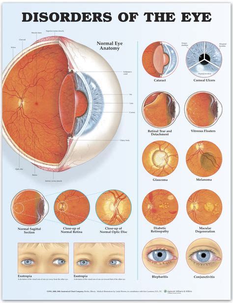 Inside The Human Eye Infographic | Eye anatomy, Eye health, Eye chart