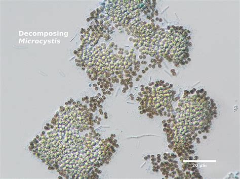 Microcystis (cyanoScope) · iNaturalist