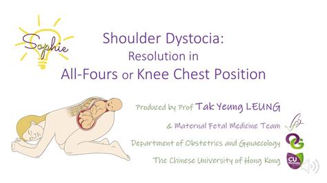 Shoulder Dystocia : Resolution in All-Fours or Knee Chest Position ...