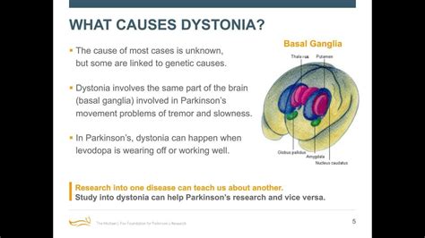 Webinar: "Cramping More than Your Style: Dystonia Causes and Care" September 2018 - YouTube