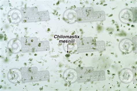 Chilomastix mesnili. 125X - Protozoa (Protozoa) - Endoparasites - Parasitology - Photos