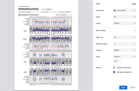 What Is Cal In Periodontal Charting - Best Picture Of Chart Anyimage.Org