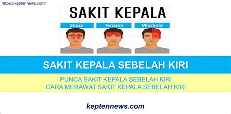 Sakit kepala kluster (Cluster Headache) Archives - keptennews.com