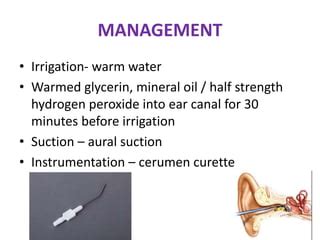 Impacted cerumen