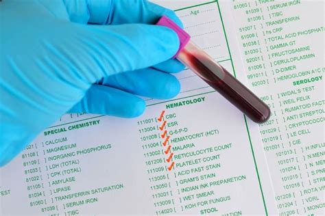 What is an ESR Test? - Facty Health