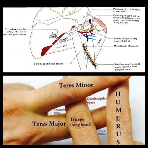 Intermuscular spaces | Medical school stuff, Medical school essentials ...