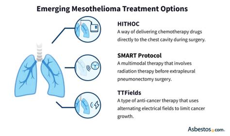 New Mesothelioma Treatments: How to Access Emerging Treatments