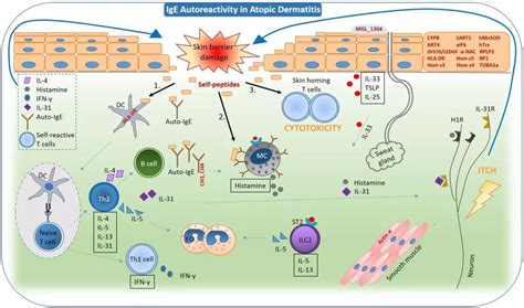 Auto-allergic: IgE-mediated with both autoimmune and allergic ...