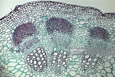 Topic Four: Diagram of vascular bundle Diagram | Quizlet