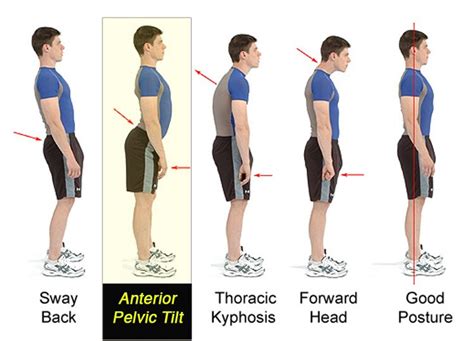 Top 3 Causes And Solutions For Love Handles - Fitneass