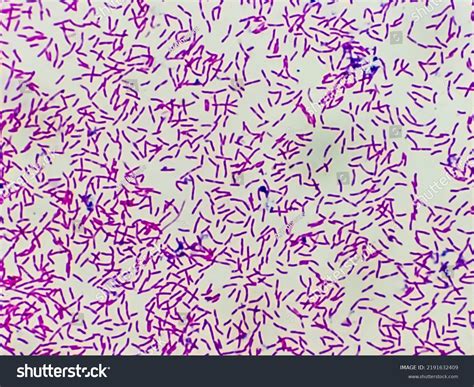 4,973 imágenes de Escherichia coli - Imágenes, fotos y vectores de ...