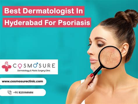 Best Dermatologist In Hyderabad For Psoriasis | Cosmosure Clinic