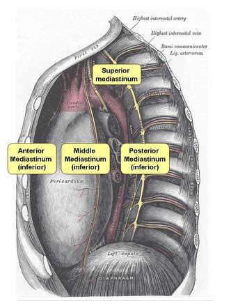 Middle mediastinum | Radiology Reference Article | Radiopaedia.org