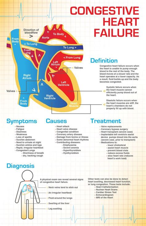 Medications that prolong life in CHF = ACEI's ABB's, Beta Blockers ...