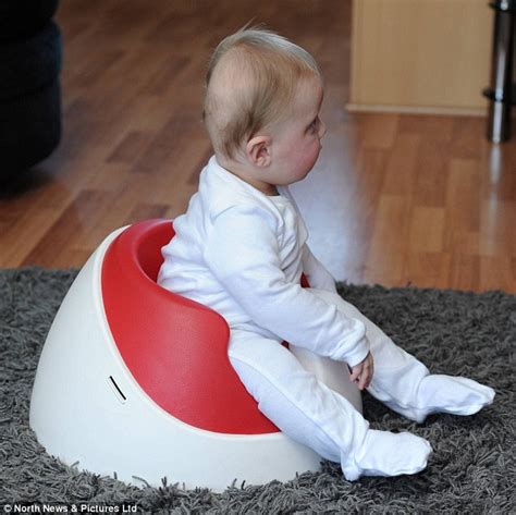 Miles Roberts with flat head syndrome now has a special helmet to treat it | Daily Mail Online