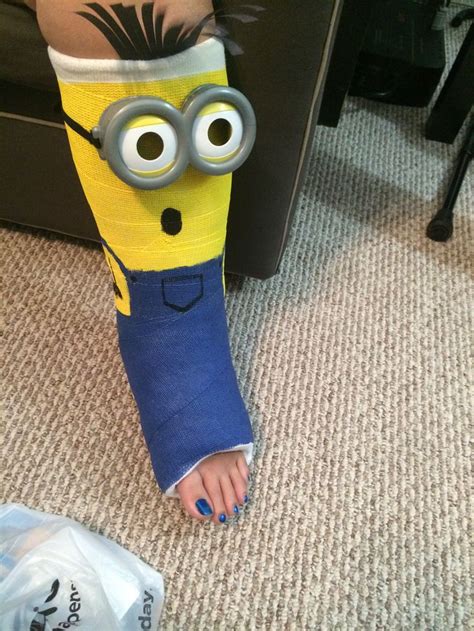 Minion leg cast design … | Leg cast, Cast decoration, Cast covers