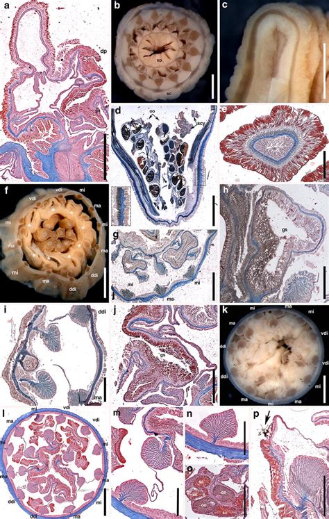 Internal anatomy and microanatomy of Halcampulactis solimar sp. nov. a ...