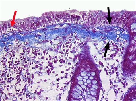 Webpathology.com: A Collection of Surgical Pathology Images