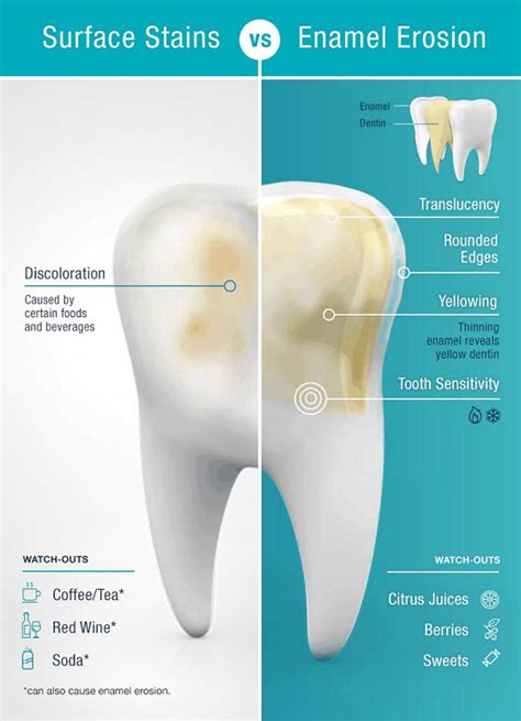 How to Treat Tooth Enamel Loss: Symptoms & Remedies