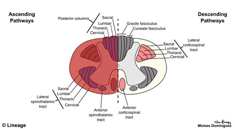 Brown-Sequard Syndrome - Neurology - Medbullets Step 1