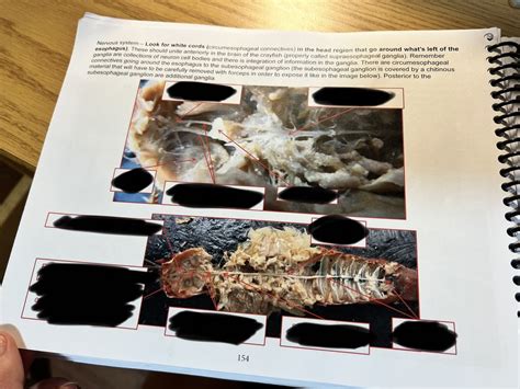 Crayfish nervous system Diagram | Quizlet