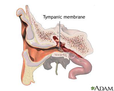 Tympanic membrane: MedlinePlus Medical Encyclopedia Image