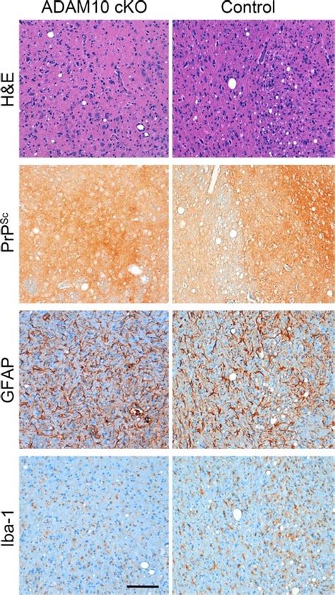 The sheddase ADAM10 is a potent modulator of prion disease | eLife