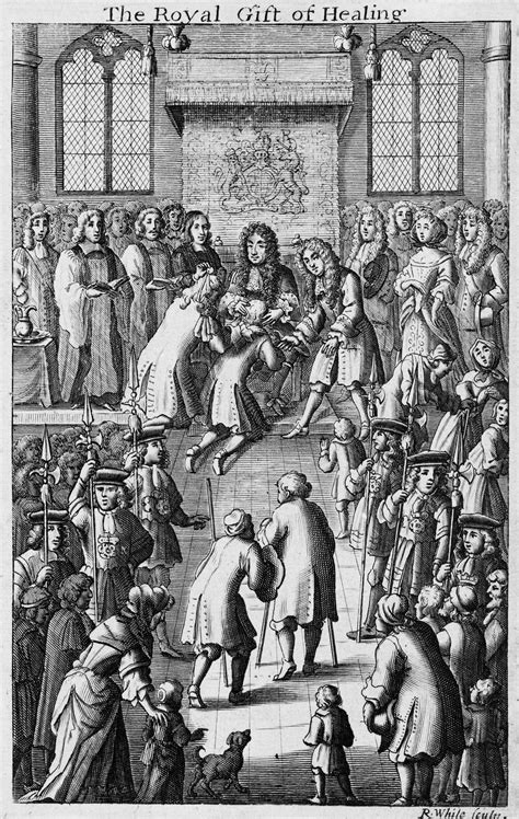 Charles II touching a patient for the King’s-Evil (scrofula) in an ...