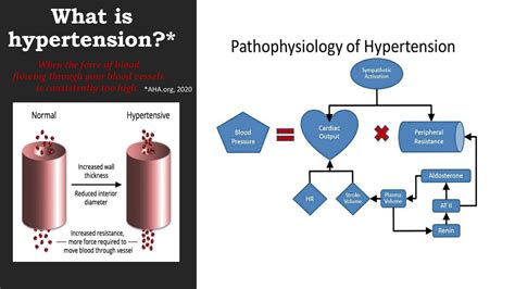 SOLUTION: Pathophysiology of Hypertension Presentation - Studypool