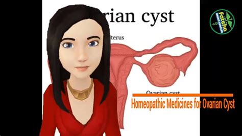 Ovarian Cysts Homeopathic Treatment - YouTube