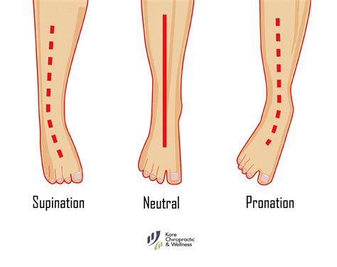 👣 Foot Biomechanics: #Supination, Neutral & #Pronation. | Orthotics, Foot biomechanics, Pronation