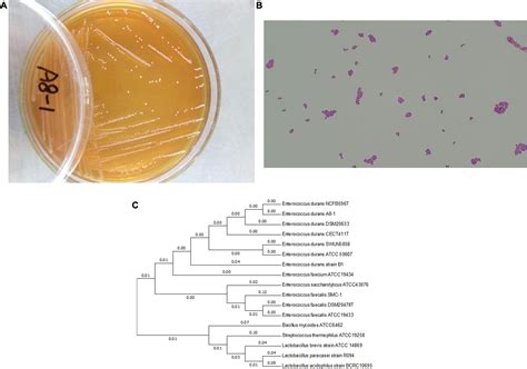 Enterococcus Faecalis Gram Stain Morphology