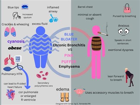 Blue bloater vs Pink Puffer | Respiratory therapy student, Respiratory ...