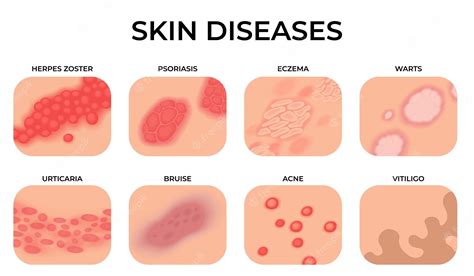 Premium Vector | Skin disease Different diseases epidermis surface with ...