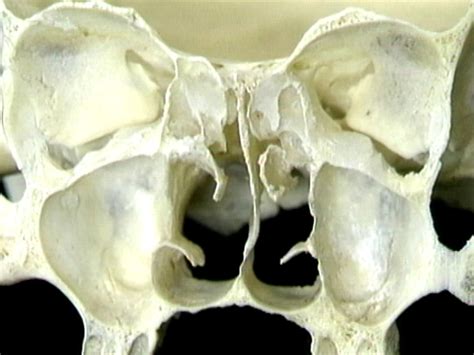 Acland`S Video Atlas Of Human Anatomy: The Head And Neck, Part I | recent movie releases ...