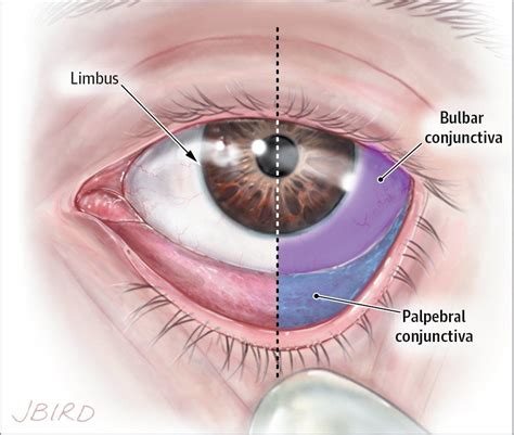 Image result for conjunctiva | Opthalmology | Eyes, Anatomy, Medical