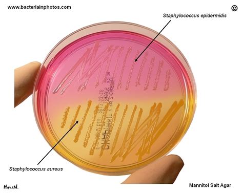 Staphylococcus aureus and Staphylococcus epidermidis on Mannitol Salt Agar. Mannitol salt agar ...