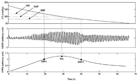 An example of the deflating cuff pressure (CP) waveform, pulsatile... | Download Scientific Diagram