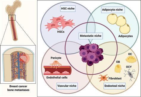 Frontiers | The Endosteal Niche in Breast Cancer Bone Metastasis