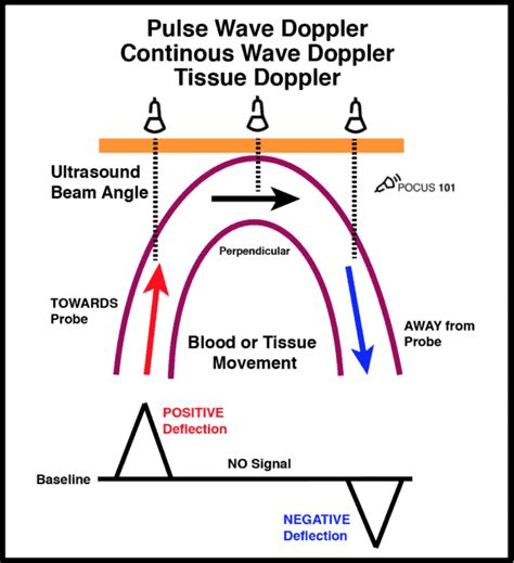 Learning Ultrasound Physics, Doppler, and Artifacts doesn’t have to be ...