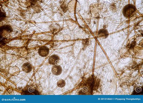 Rhizopus Fungal Hyphae In Tissue Biopsy Specimen Stock Photography | CartoonDealer.com #221540666