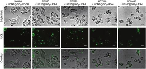 UCL images of SW480 cells, SW620 cells, HCT116 cells, and NCM460 cells ...