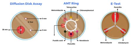 Testing antimicrobial susceptibility - Labster