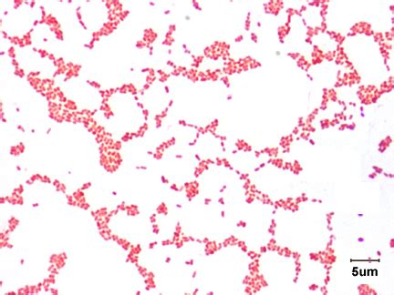 BIOL 230 Lab Manual: Gram Stain of Proteus vulgaris